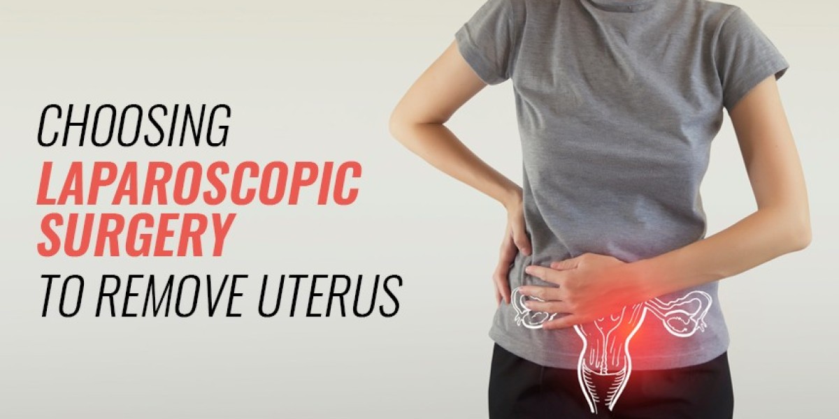 Laparoscopic Surgery to Remove Uterus | World of Urology