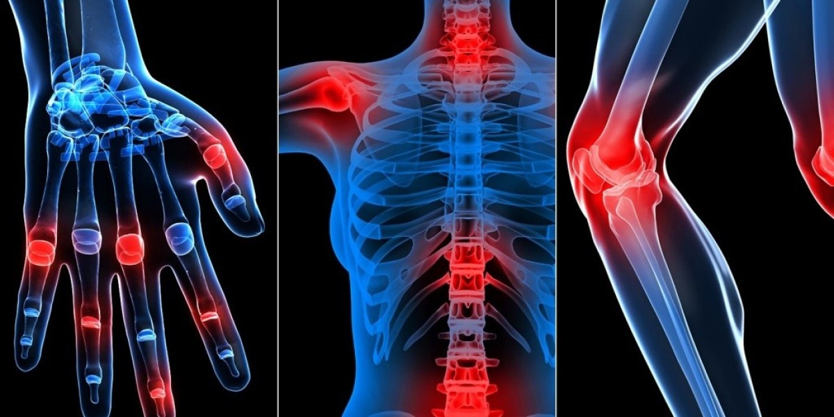 Arthritis Therapeutics Market: The Impact of Innovative Therapies