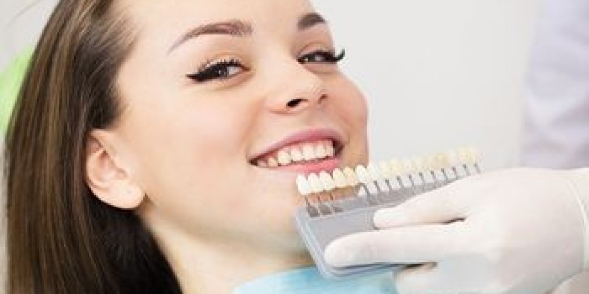 Cosmetic Dentistry Trends in Mississauga: Achieving the Perfect Smile