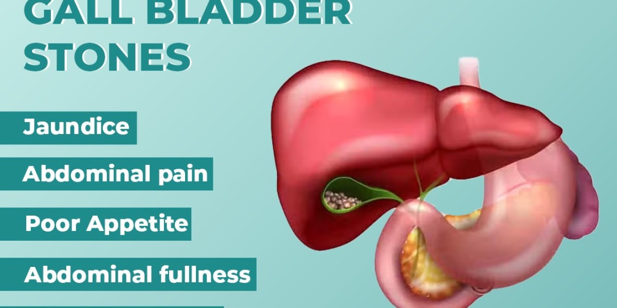 Your Destination for the Best Gallbladder Treatment