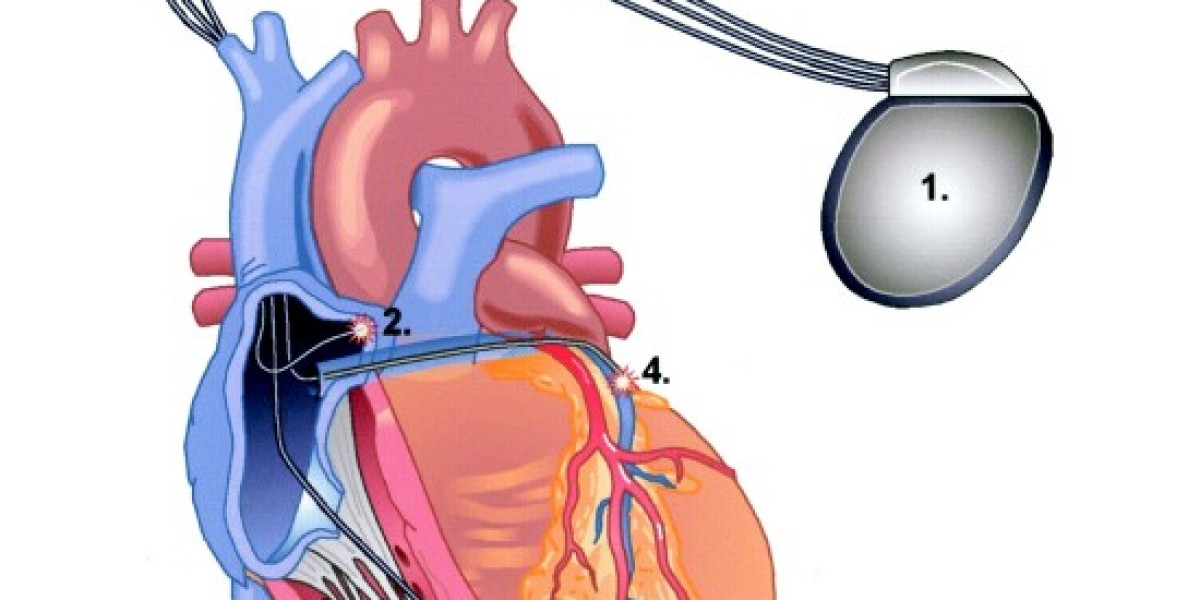 Cardiac Resynchronization Therapy Devices Market Dynamics & Forecast Report to 2032