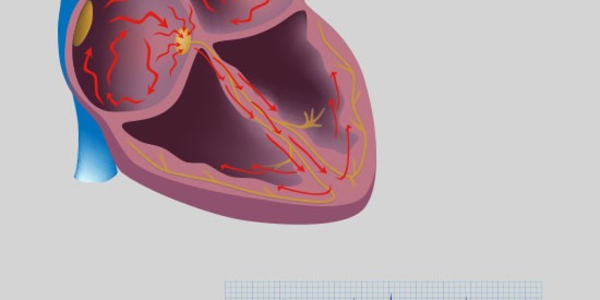 Atrial Fibrillation Market 2023 Major Key Players and Industry Analysis Till 2032