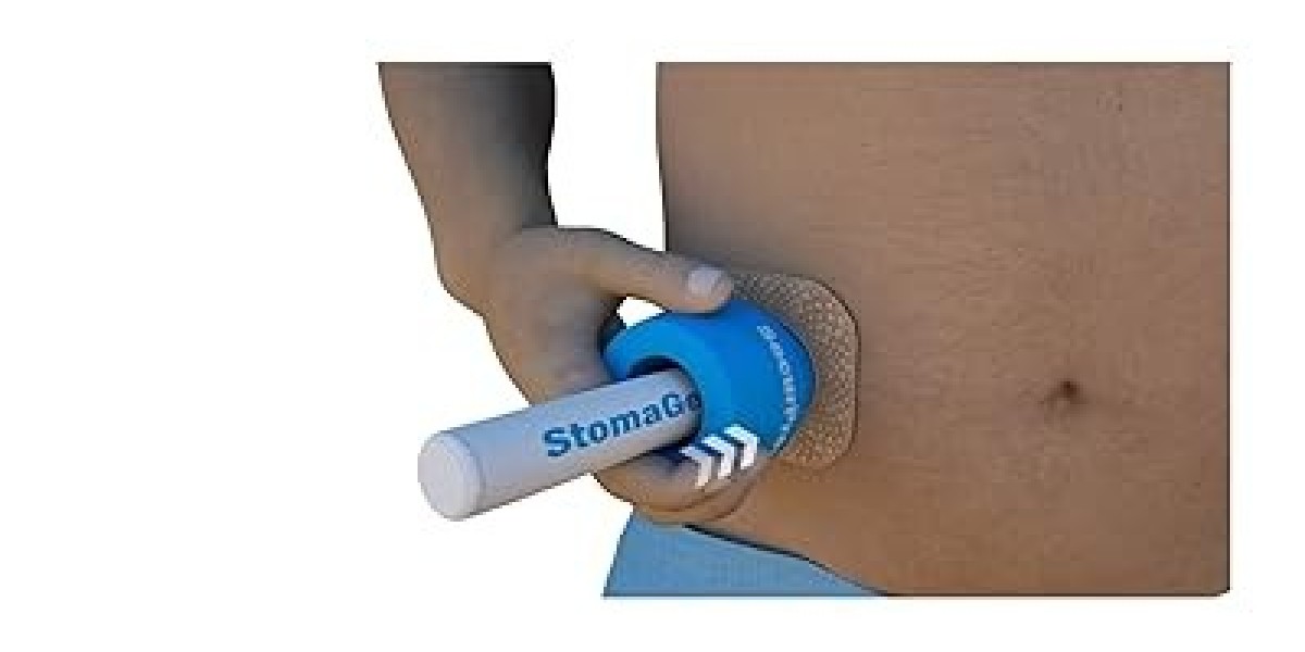 Ostomy Devices Market: Personalized Care and Customization Driving Innovation