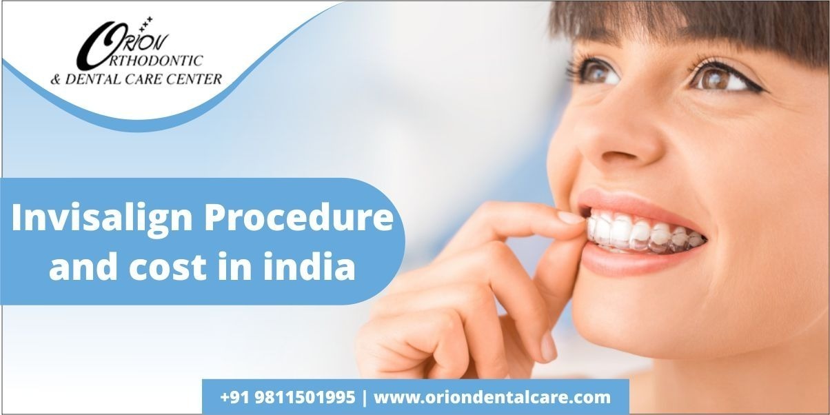 How Does Invisalign Work? | How Much Does Invisalign Cost in India?