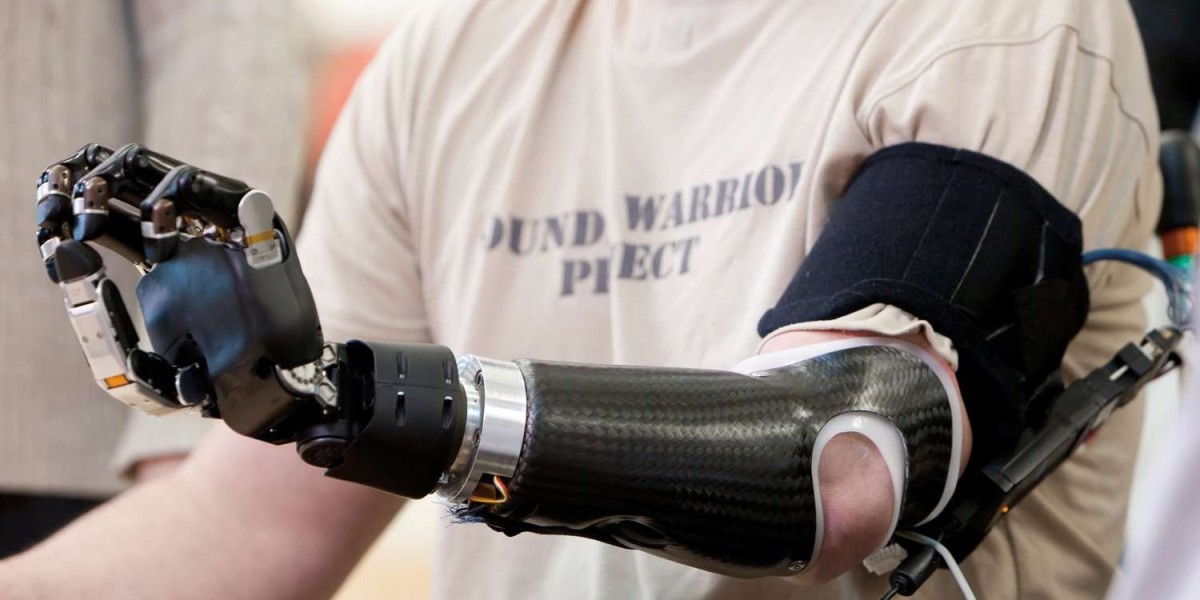 Artificial Limbs Market: Exploring the Latest Innovations in Prosthetic Design