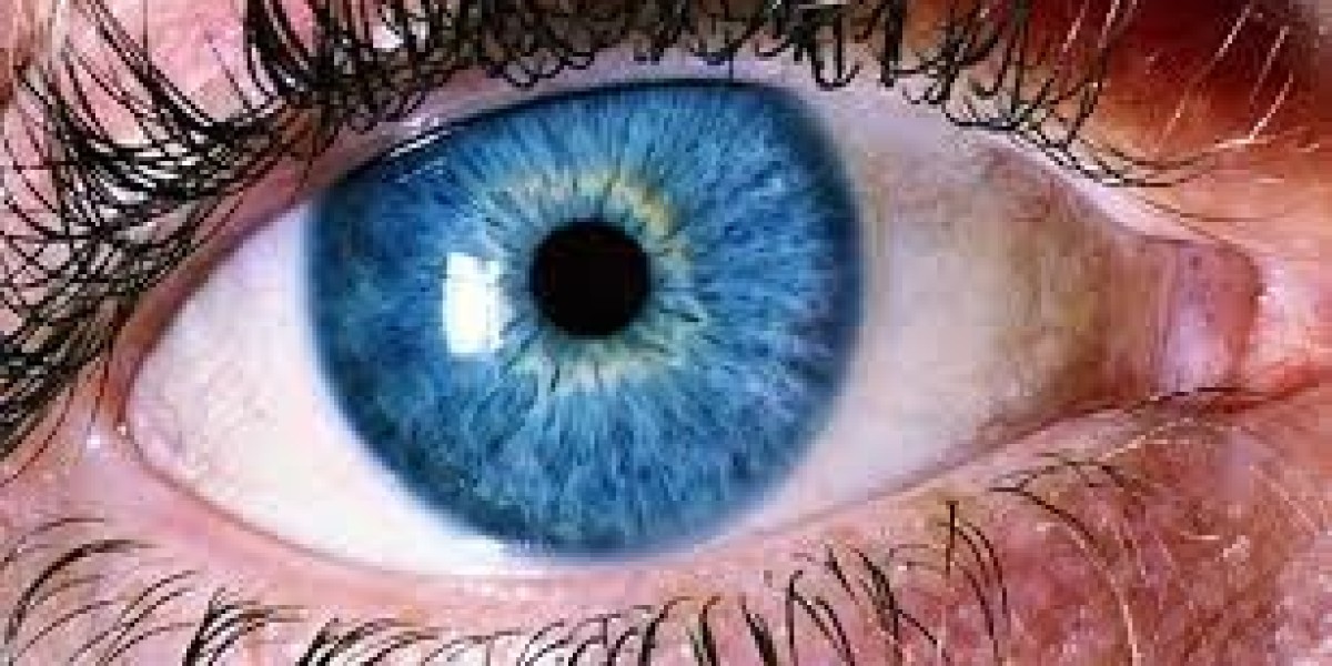 Retinal Detachment Disorder Market: Global Trends, Growth Analysis, and Forecast (2021-2030)