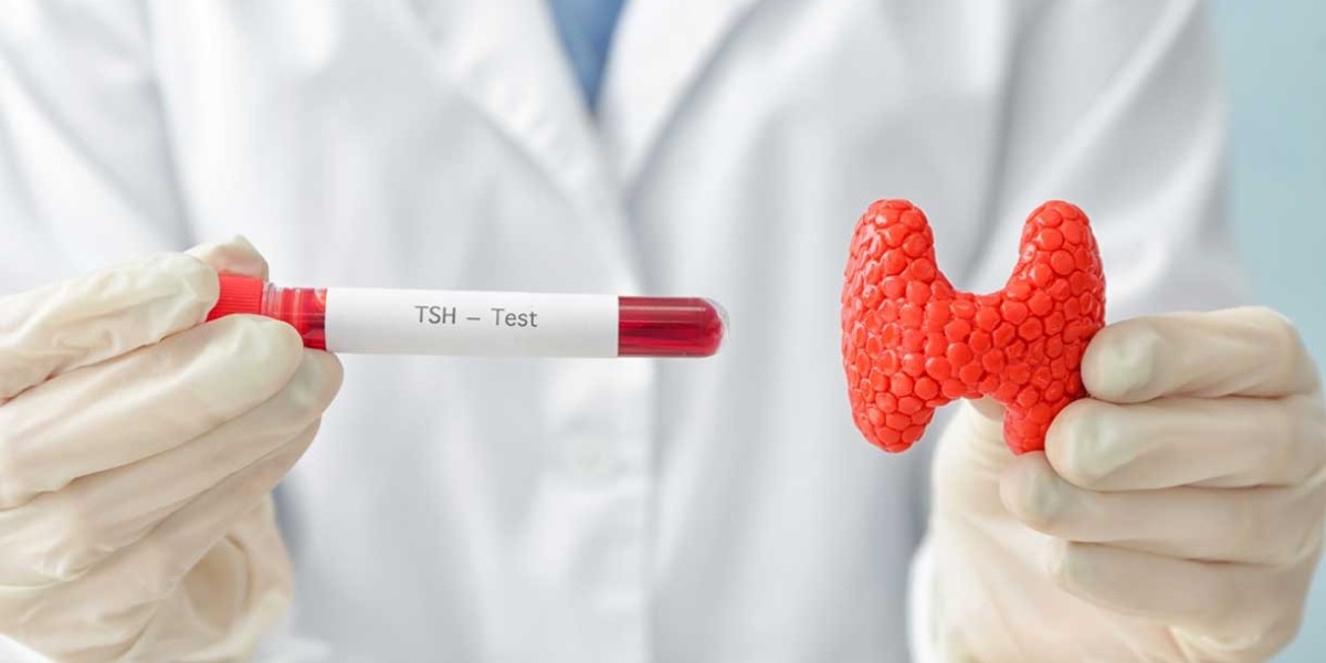 Thyroid Function Test Market Dynamics: Analyzing the Core Factors Influencing Market Expansion, Challenges, and Strategi