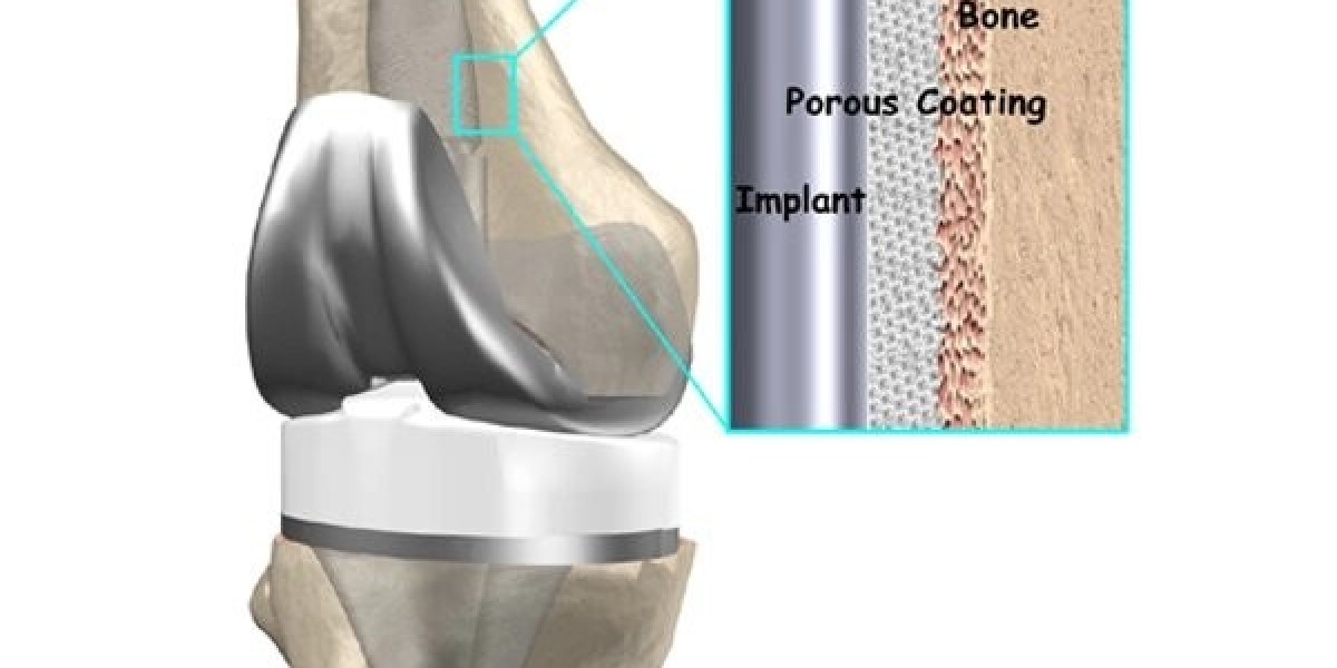 Best Joint Replacement Surgeon in Jaipur