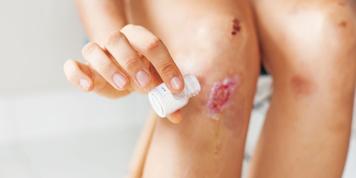 Wound Cleanser Market: Analyzing Growth Drivers, Market Trends, and Consumer Preferences