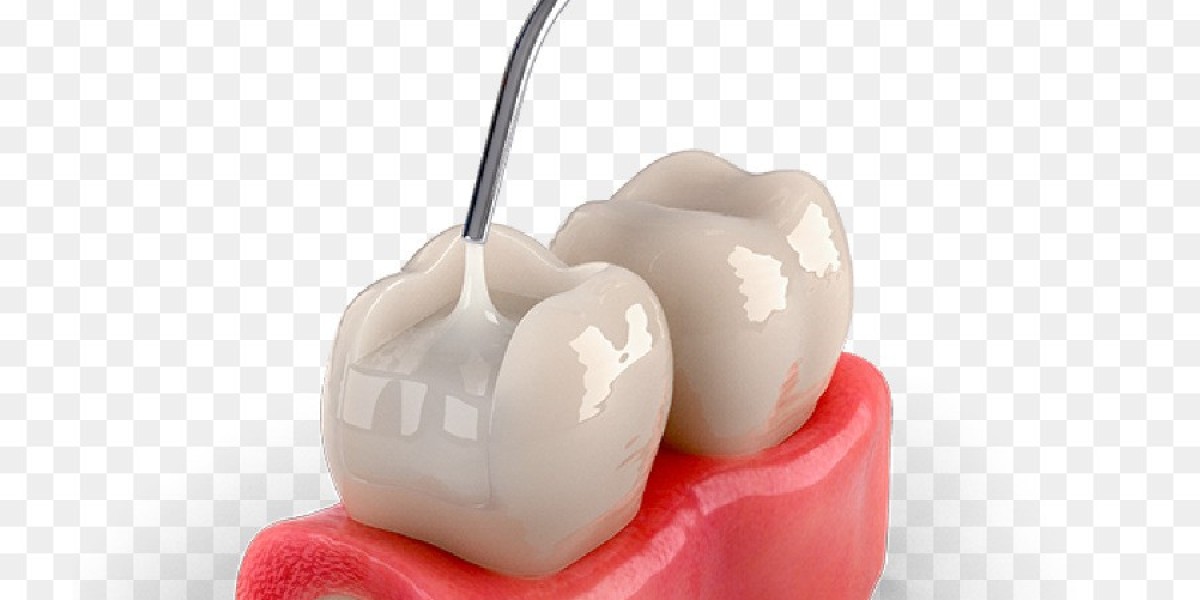 Tooth Filling Materials Market Trends: Shifting Consumer Preferences and the Growing Demand for Aesthetic Solutions