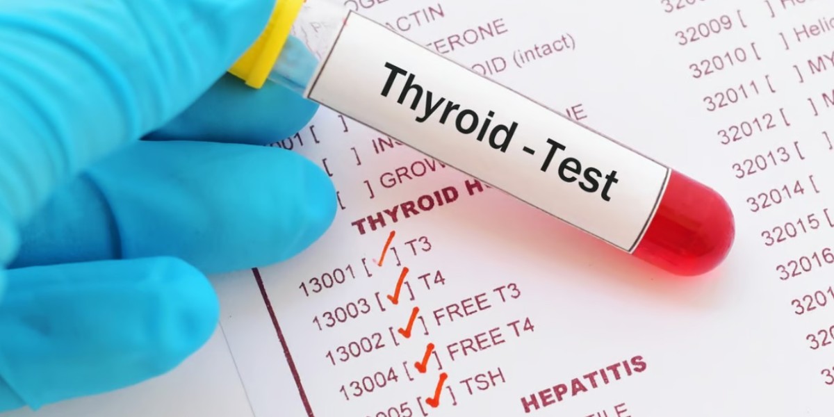 Thyroid Function Test Market: Examining Barriers and Developing Winning Strategies for Industry Success