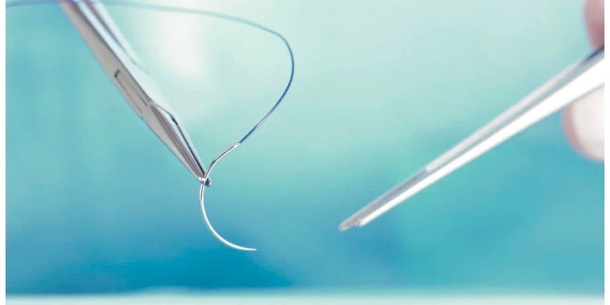 Veterinary Sutures Market Growth: How Advancements in Technology are Shaping Pet Care