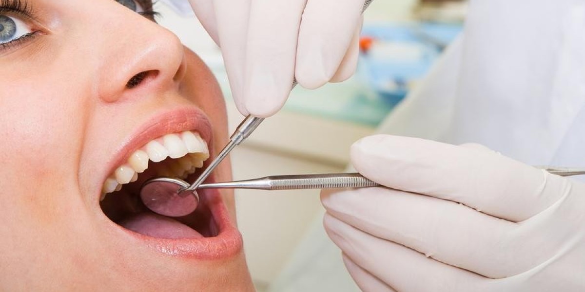 The Complete Guide to Dental Implants