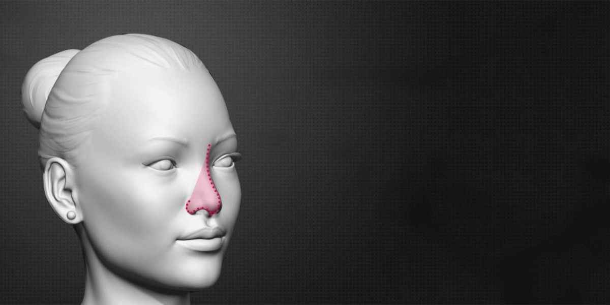 When is Chin Surgery Performed with Rhinoplasty?