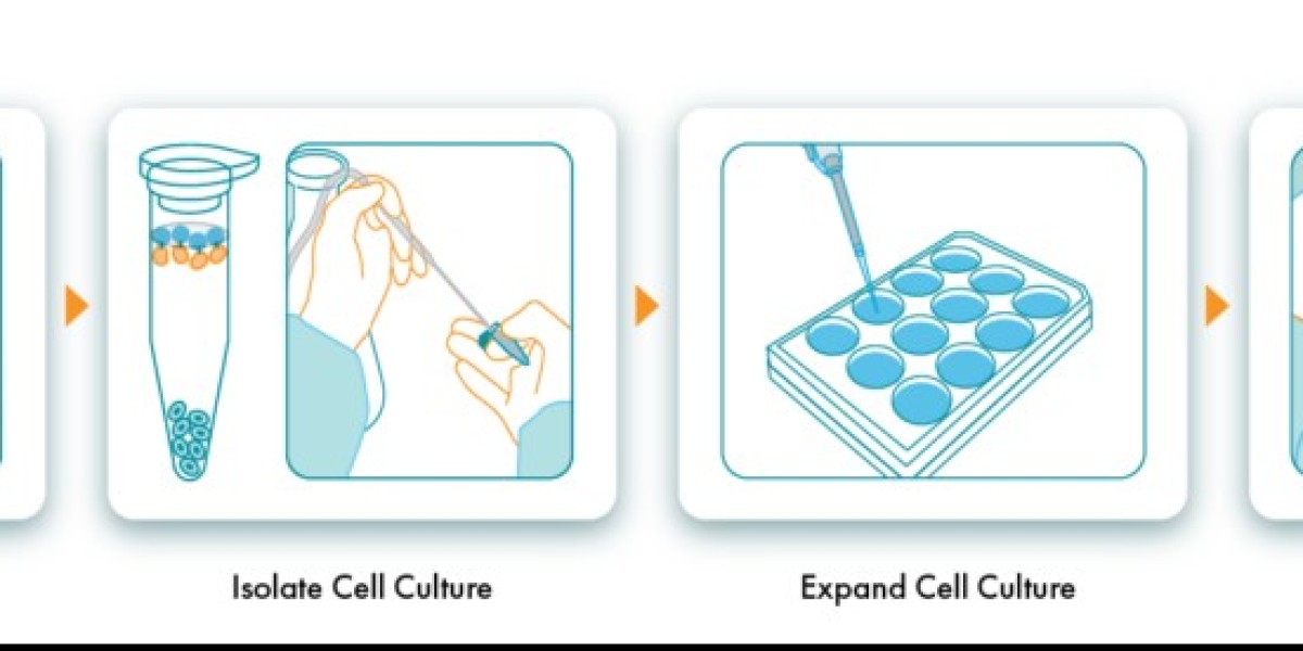 Autologous Cell Therapy Market Impacting Factors: Investment in Biotechnology Propels Market Expansion and Development