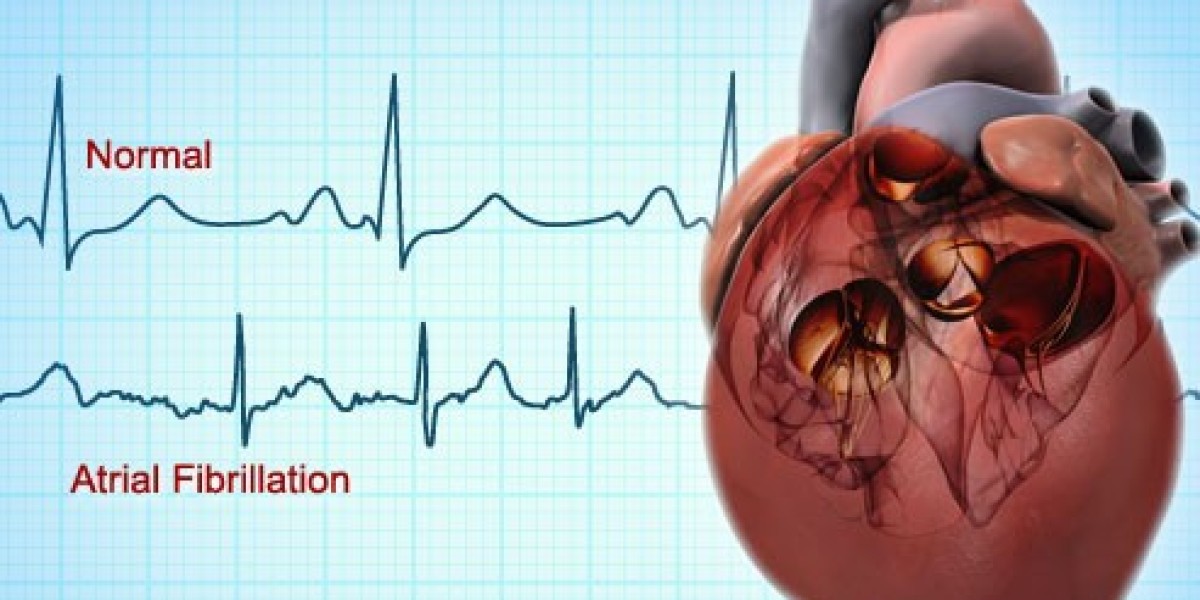 Atrial Fibrillation (Afib) Market Scenario: Analyzing the Impact of Aging Populations on Afib Prevalence