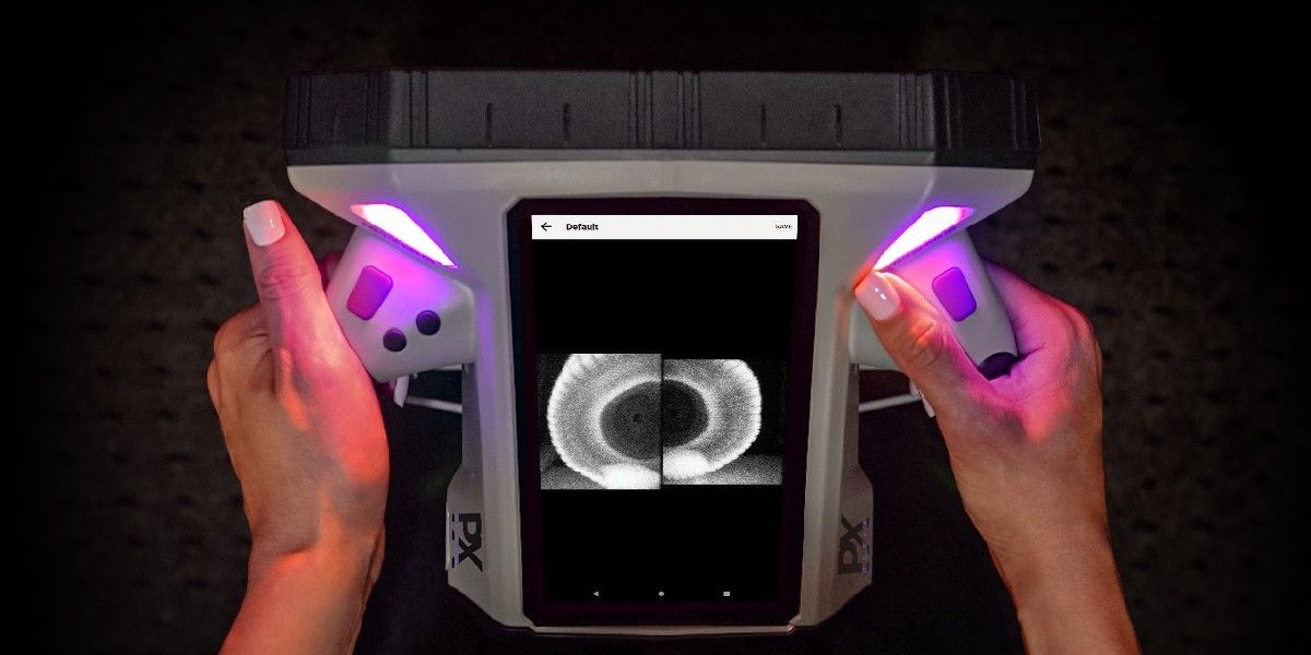 Handheld X-ray Scanners Market: Size, Share, Trends, and Growth Forecast from 2023 to 2033