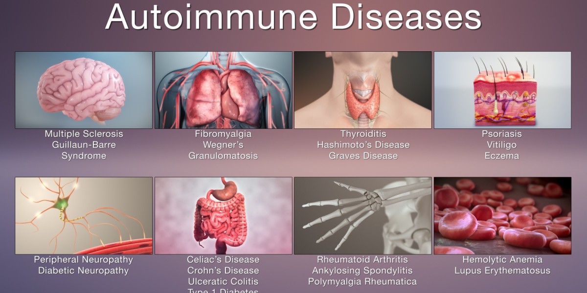 Autoimmune Disease Diagnostics Market Scenario: Exploring Market Segmentation, Regional Insights, and Future Forecasts