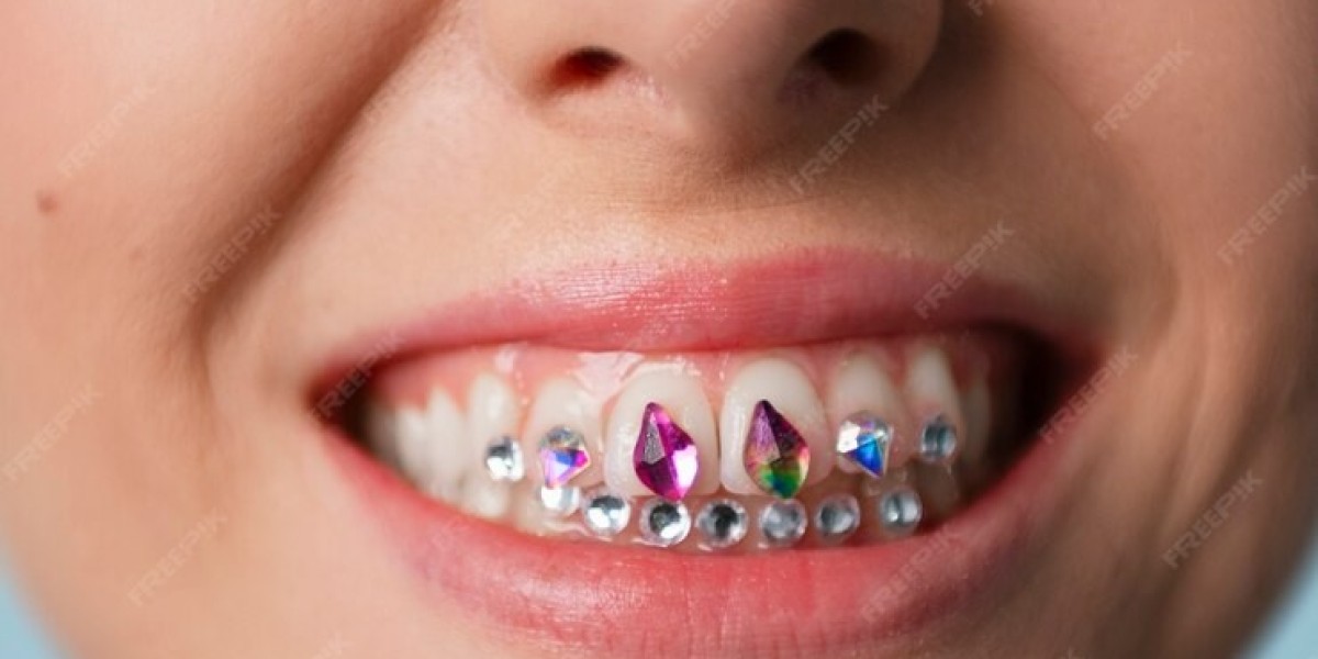 Enhance Your Smile with Stunning Tooth Gems Near Me