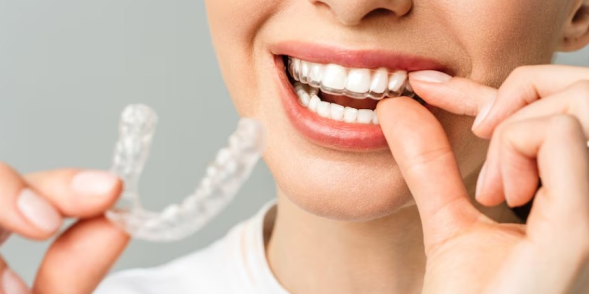 What Does Invisalign Treatment Include?