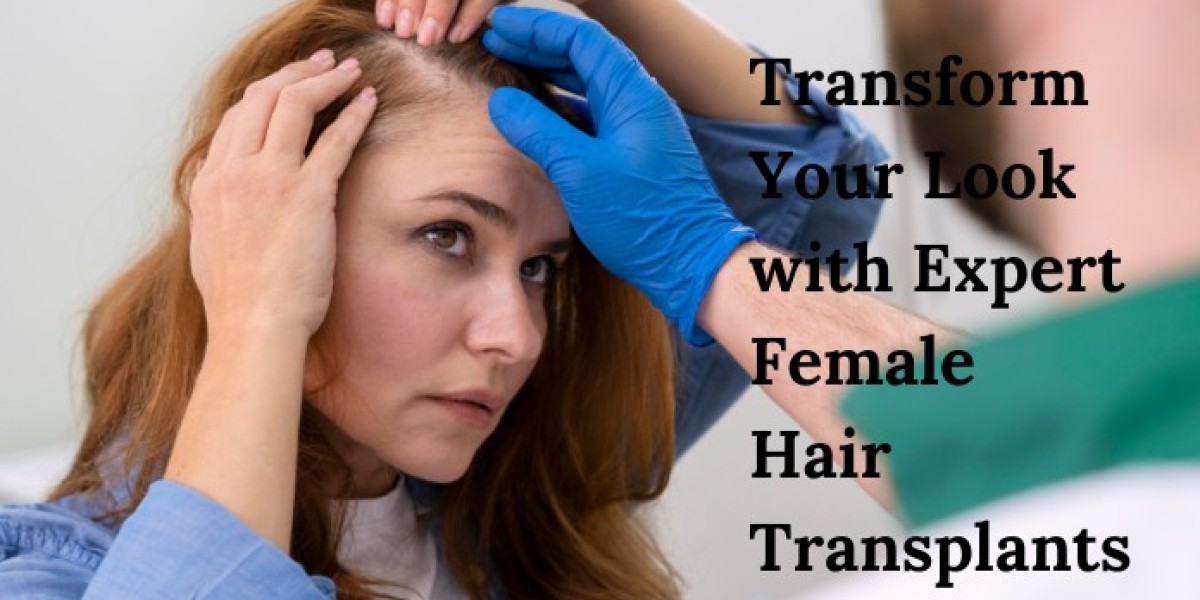 Transform Your Look with Expert Female Hair Transplants