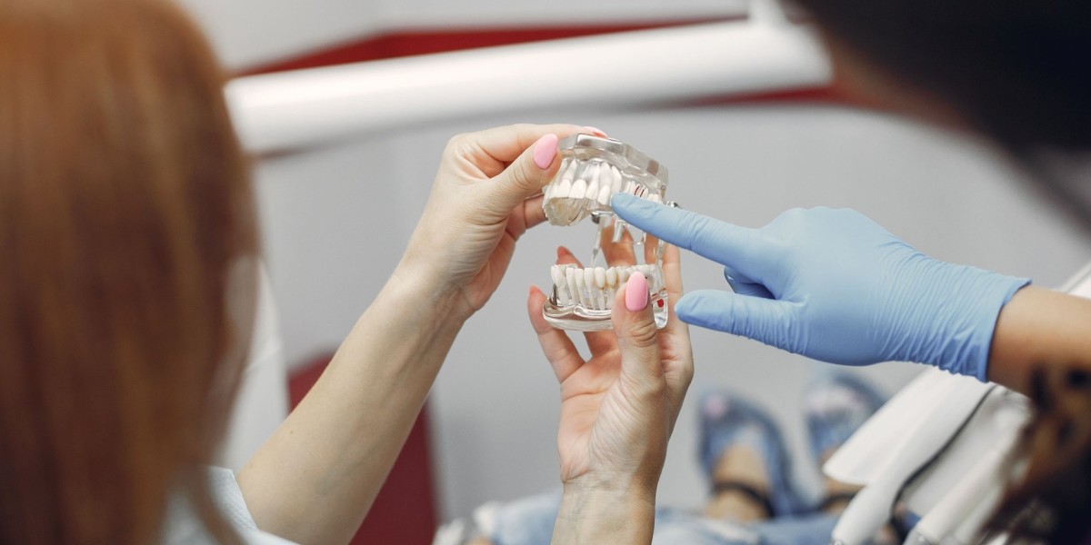 How Long Does a Dental Implant Last?