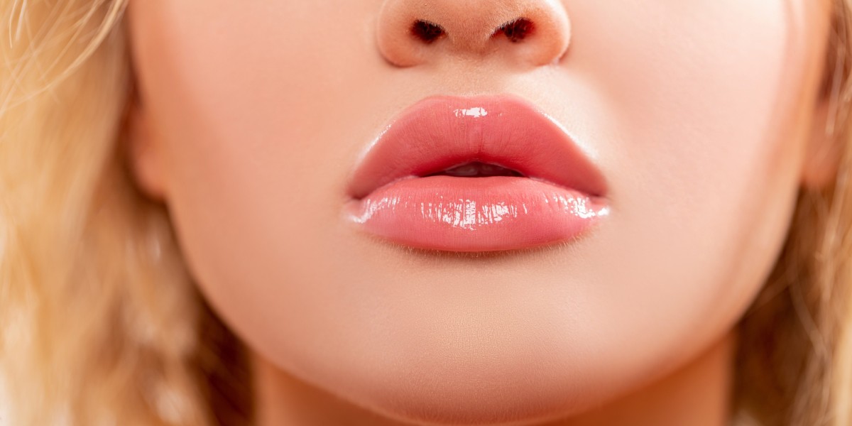 The Ultimate Guide to Getting Lip Fillers in Dubai: Pros, Cons, and Tips