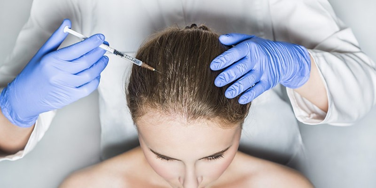 PRP Hair Treatment in Dubai: A Revolutionary Solution for Hair Loss