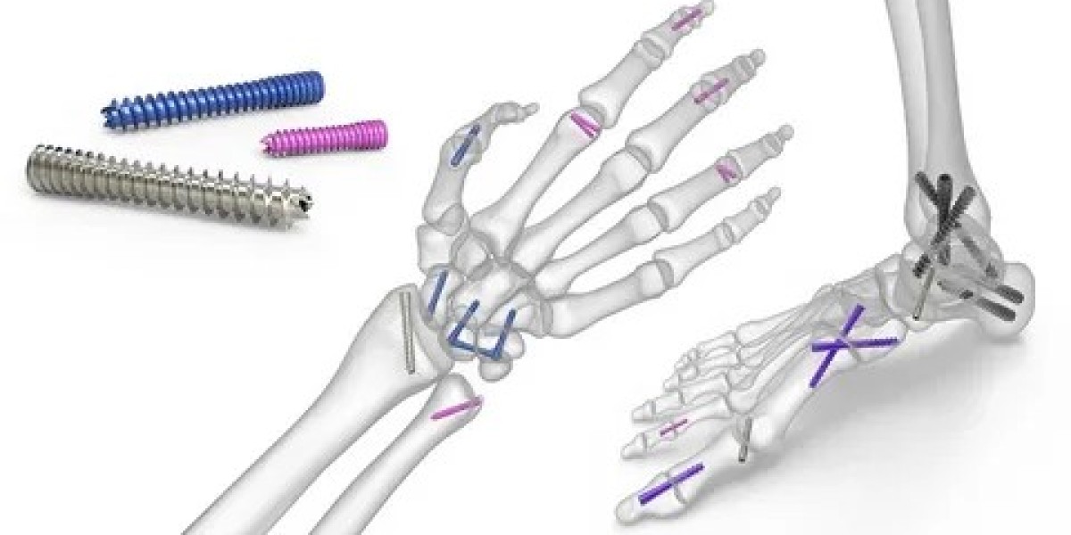 Bone Fixation Plates Market Scenario: Aging Population and Technological Innovation Driving Market Expansion