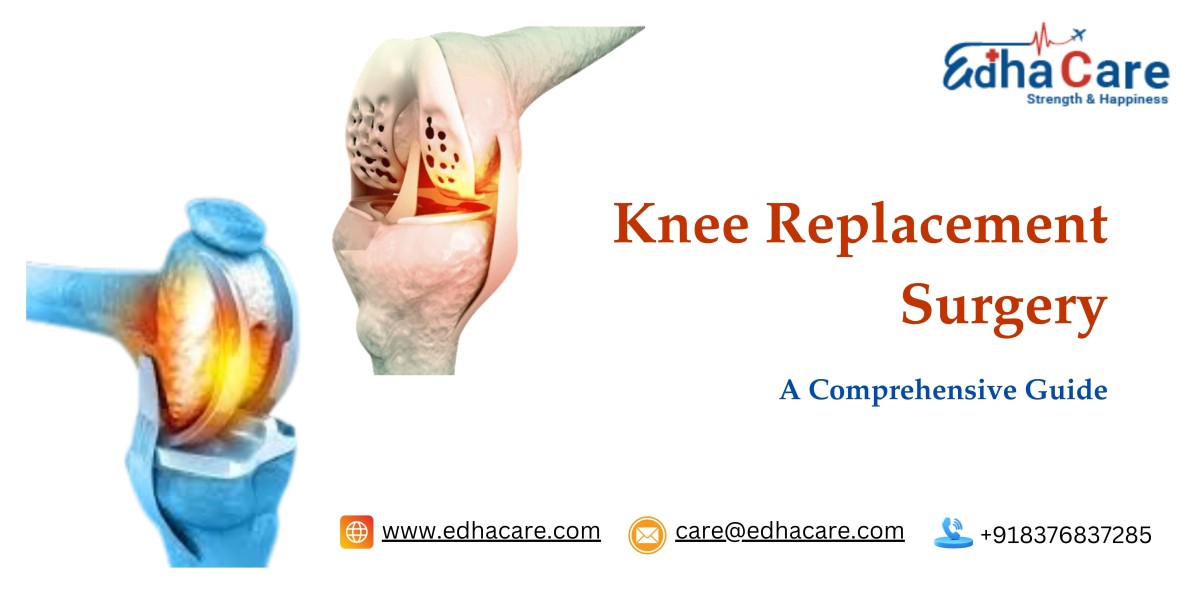 A New Lease on Life: Knee Replacement Surgery