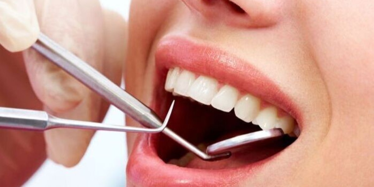 The Importance of General Dentistry: A Comprehensive Guide to Quality Dental Care in Dubai