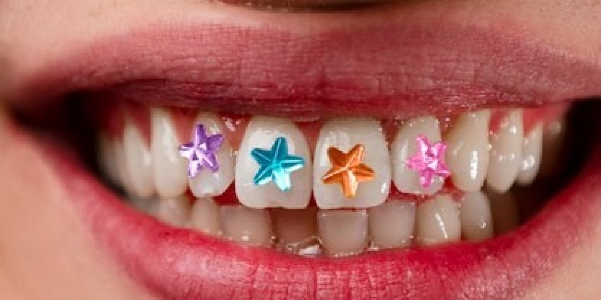 Swarovski Tooth Gems: The Safe and Stylish Way to Add Sparkle to Your Smile