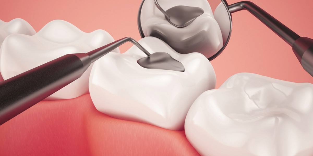 Tooth Filling Materials Market Threats Affecting Growth Sustainability And Competitive Landscape